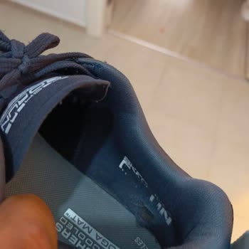 Skechers Ayakkabıda 5 Ayda Yıpranma Ve Garanti Sorunu: Hayal Kırıklığı