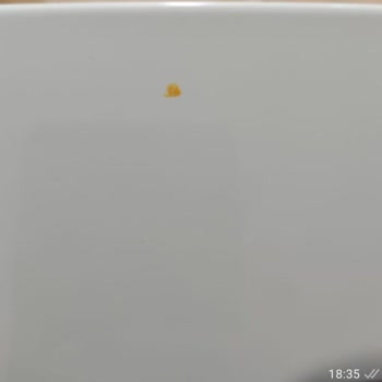 Satın Aldığım Bosch Buzdolabı Ve Davlumbazda Sürekli Arıza Ve Servis Sorunları