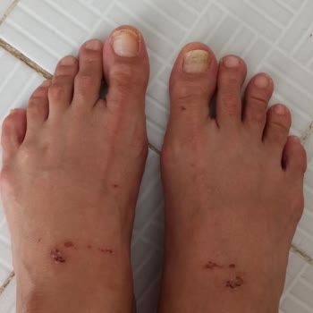 Bir Kez Giyilen Terlik Yaraladı, İade Talebim Reddedildi Mağdur Edildim