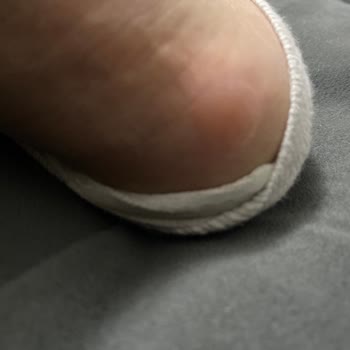 Aldığım Ayakkabı Orijinal Değil Deforme Ve Sağlıksız Çıktı İade Kabul Edilmiyor