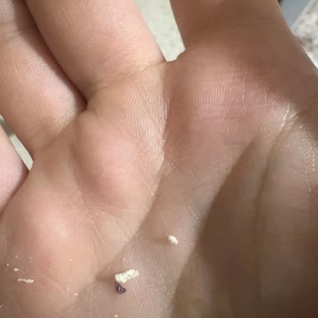 Bebelac1 Devam Sütünde Yabancı Madde Çıkması Ve Mağduriyet