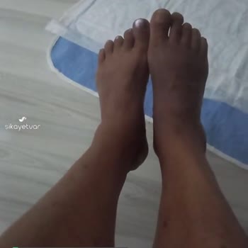 Ayak, MR Sonuç Raporu Etlik Şehir Hastanesinde Çıkmıyor!