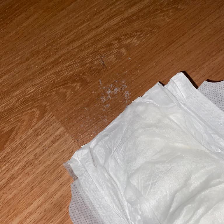 Bebek Bezinden Çıkan Yabancı Madde Endişesi Ve Müşteri Hizmetlerinden Dönüş Alamama