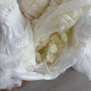 Molfix Bebek Bezinde Sızdırma Ve Pişik Sorunları Nedeniyle Para İadesi Talebi