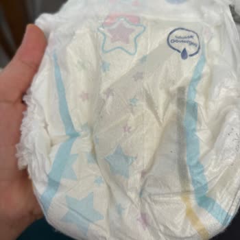 Molfix Bebek Bezinde Sızdırma Ve Pişik Sorunları Nedeniyle Para İadesi Talebi