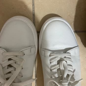 Kısa Sürede Deforme Olan Ayakkabıda Beklenmedik Kalite Sorunu Ve Değişim Talebi