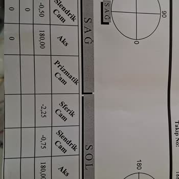 Lazer Göz Ameliyatı Sonrası Artan Göz Derecesi Ve Hastane İlgisizliği