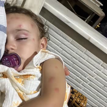 Mahallede Artan Sivrisinek Ve Böcek Sorunu Nedeniyle Acil İlaçlama Talebi