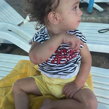 Mahallede Artan Sivrisinek Ve Böcek Sorunu Nedeniyle Acil İlaçlama Talebi