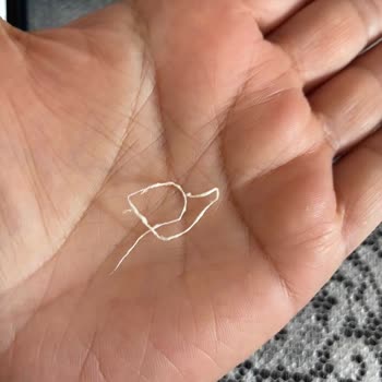 Ünal Peynircilik Beyaz Peynirde Yabancı Madde Ve Hijyen Endişesi