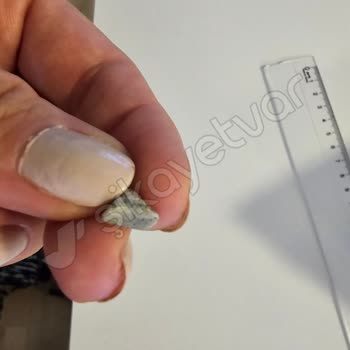 Dardanel Sandviçten Taş Çıkması Ve Müşteri Hizmetlerinden Dönüş Alamama