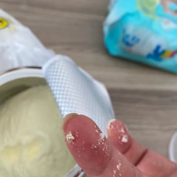 Bebek Mamasında Yabancı Cisim Şoku Ve İade Sorunu