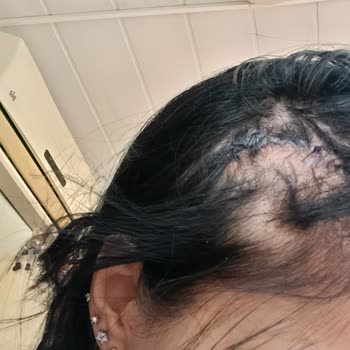 Yaşar Hastanesi Ameliyat Sonrası Sonuçsuzluk Ve İlgisizlik Nedeniyle Mağduriyet