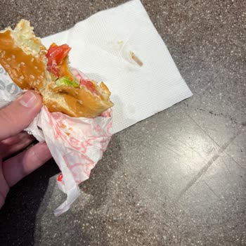 Hamburgerde Çıkan Kemik Parçası Sağlığımı Ciddi Şekilde Tehlikeye Attı