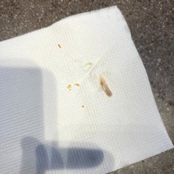 Hamburgerde Çıkan Kemik Parçası Sağlığımı Ciddi Şekilde Tehlikeye Attı