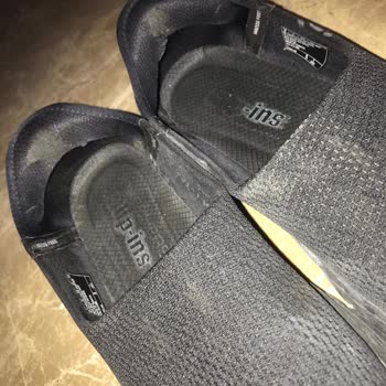 Ayakkabının Topuk Kısmı Yara Yaptı Ve Kısa Sürede Ciddi Deformasyon Oluştu