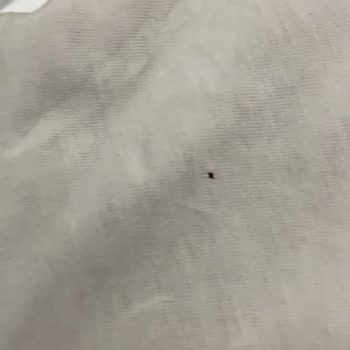 Siemens Çamaşır Makinesi Kıyafetleri Parçalıyor, Kullanıcı Hatası Denilerek Mağdur Ediliyorum