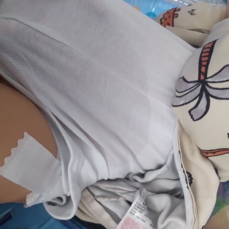 Püre Baby Bebek Bezlerinde Sızıntı Ve Kopan Bantlar Mağduriyet Yaşatıyor