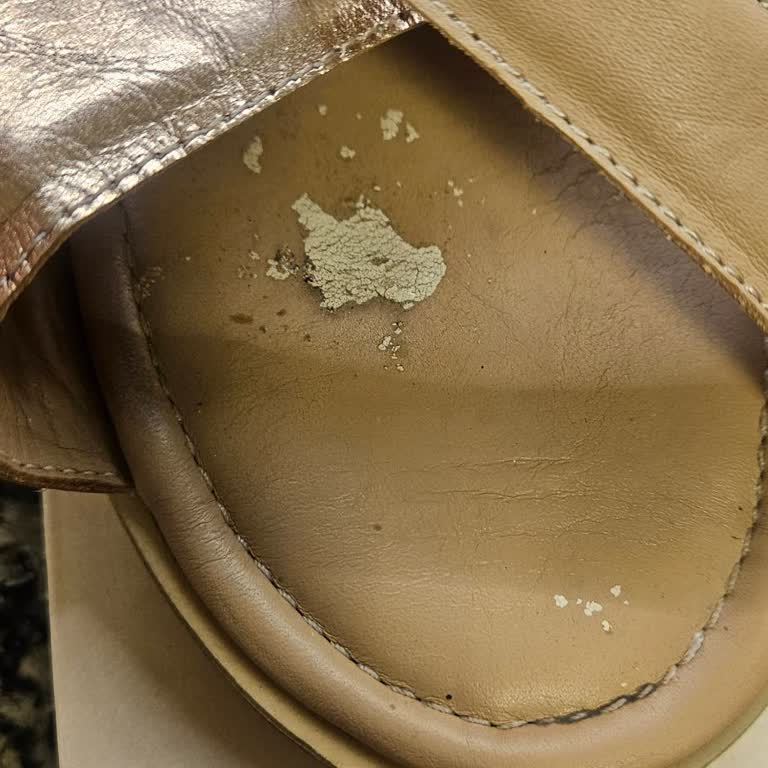 Az Kullanılan Sandaletin Tabanı Soyuldu, Değişim Talebim Reddedildi