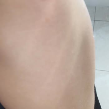 Gillette Venüs Turuncu Tıraş Bıçağı Ciltte Kesiklere Sebep Oldu