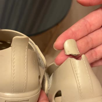 Kısa Sürede Yırtılan Sandalet Ve Orijinallik Şüphesi İçin Ücret İadesi Talebi