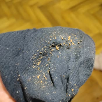 Greyder Satın Aldığım Ayakkabıda Deformasyon Ve İade Sorunu