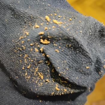 Greyder Satın Aldığım Ayakkabıda Deformasyon Ve İade Sorunu