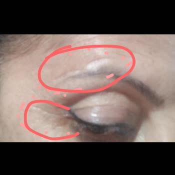 Lokman Hekim Hastaneleri Doktordan Şikayetçiyim