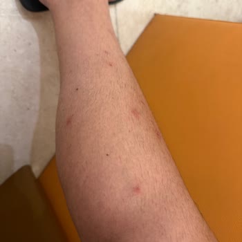 Pronto Tour İtalya Turunda Yetersiz Rehberlik, Eksik Program Ve Hijyen Sorunları Mağduriyeti