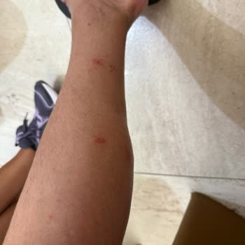 Pronto Tour İtalya Turunda Yetersiz Rehberlik, Eksik Program Ve Hijyen Sorunları Mağduriyeti