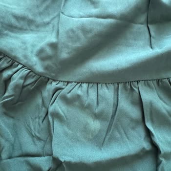 Lekeli Ürün Ve Geciken İade Süreci Mağduriyet Yaratıyor