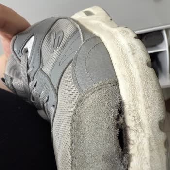 Garanti Sürecinde Yaşanan Destek Eksikliği Ve Fotoğraf Yükleme Sorunu