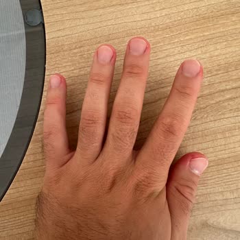 Opet Oto Yıkamada Kullanılan Kimyasal Köpük Kıyafetlerimi Kalıcı Şekilde Lekeledi!