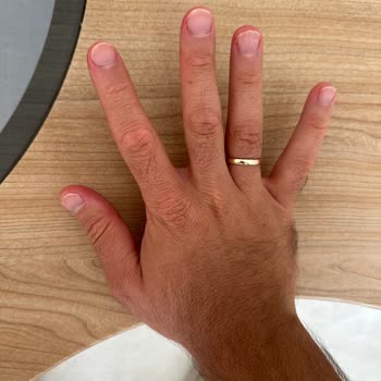 Opet Oto Yıkamada Kullanılan Kimyasal Köpük Kıyafetlerimi Kalıcı Şekilde Lekeledi!