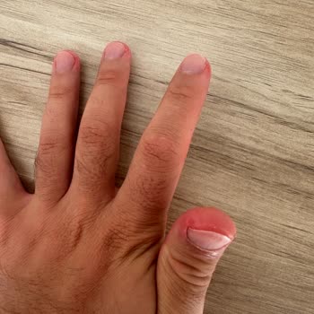 Opet Oto Yıkamada Kullanılan Kimyasal Köpük Kıyafetlerimi Kalıcı Şekilde Lekeledi!