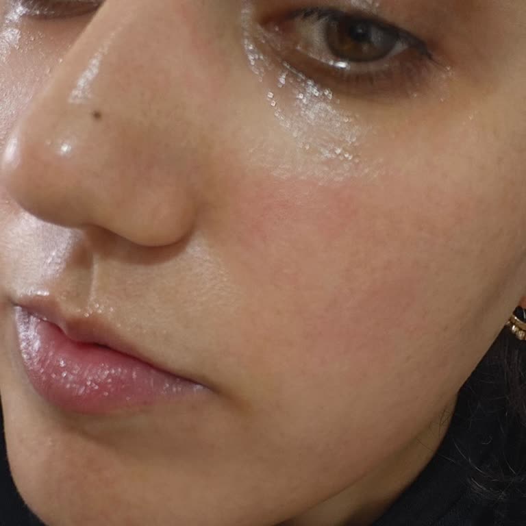 Caudalie Vinoperfect Salisilik Serum İlk Kullanımda Ciltte Şiddetli Yanma Ve Kızarıklık Oluşturdu