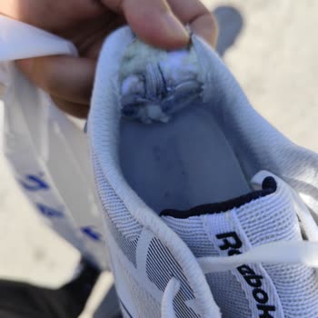 Satın Alınan Ayakkabının Kısa Sürede Deforme Olması Ve Garanti Talebinin Reddedilmesi