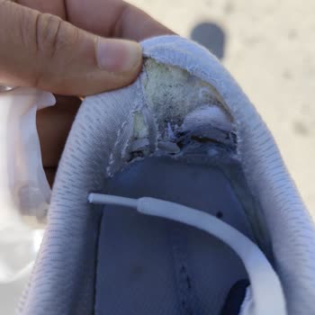 Satın Alınan Ayakkabının Kısa Sürede Deforme Olması Ve Garanti Talebinin Reddedilmesi