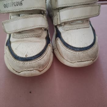 Satın Alınan Çocuk Ayakkabılarında Kısa Sürede Kalite Sorunu ve Mağaza İlgisizliği