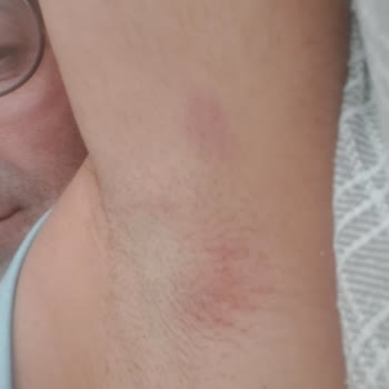 İlk Kullanımda Hayal Kırıklığı: Cilt Tahrişi Ve Düzgün Kesim Yapmayan Tıraş Makinesi