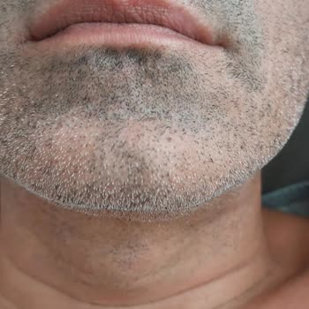 İlk Kullanımda Hayal Kırıklığı: Cilt Tahrişi Ve Düzgün Kesim Yapmayan Tıraş Makinesi