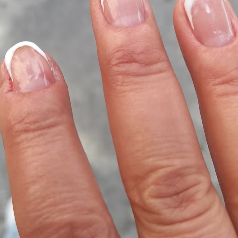 Studio 44 Beauty Nail Yüzünden Tırnak Etlerimde Yara, Tahriş, Şekil Bozukluğu Ve Ciddi Acıma Oluştu