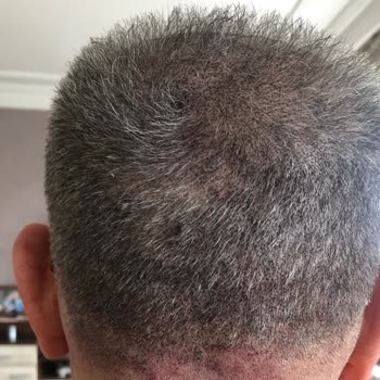 İlknur Güneş Beauty Clinic İşinin Ehli Değil