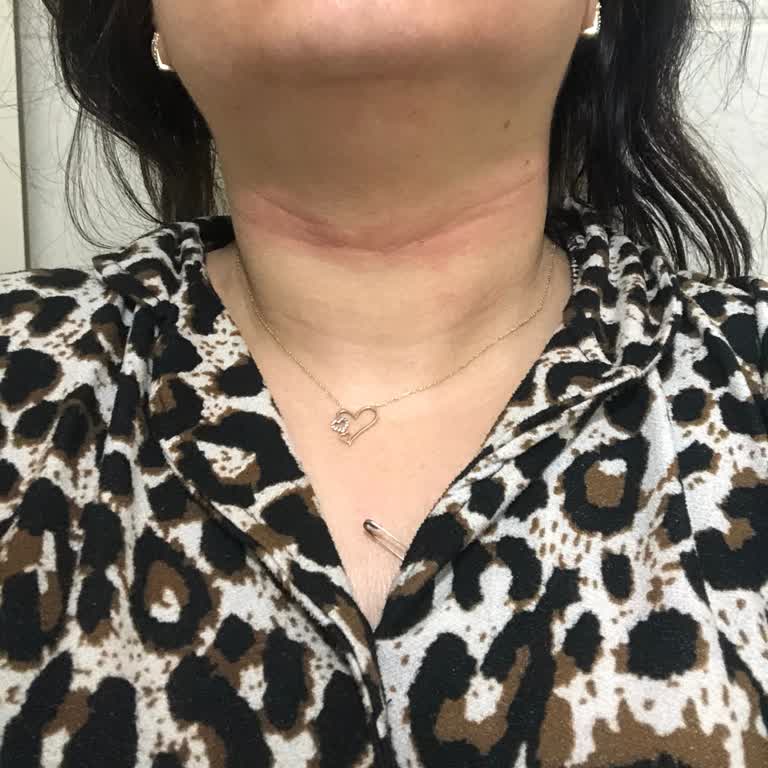 Büşra Arslan Güzellik Salonu Dermapen Seanslarım Yapılmadı Salon Aramalarıma Cevap Vermiyor