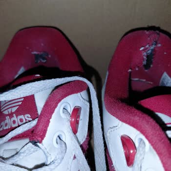 Adidas Ayakkabıda Topuk Yırtığına Çözüm Bulunmuyor