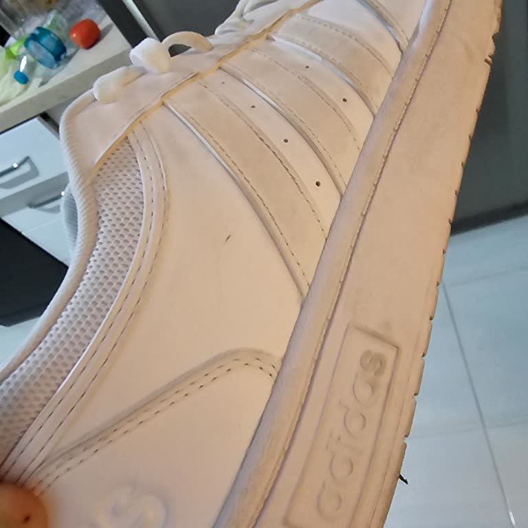 Adidas Mağazasından Alınan Ayakkabının Ayağı Yara Yapması Ve İlgisiz Mağaza Yetkilisi