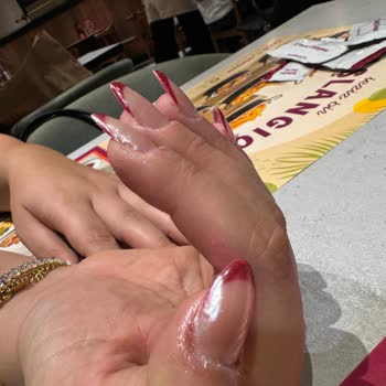 Kötü Tırnak Uygulaması Sonrası İlgisizlik Ve Ücret İadesi Talebi