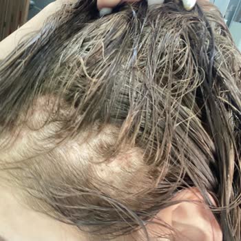 Yanlış Saç Uygulaması, Eksik İade Ve Faturasız İşlemle Mağdur Edildim