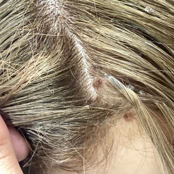 Yanlış Saç Uygulaması, Eksik İade Ve Faturasız İşlemle Mağdur Edildim