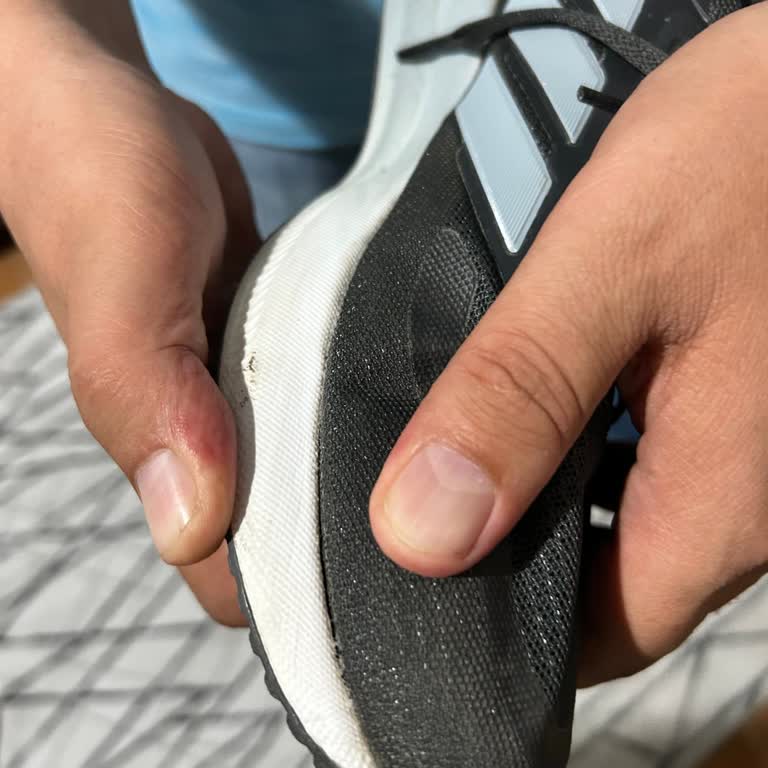 Kısa Sürede Tabanı Ayrılan Adidas Ayakkabım İçin Değişim Veya İade Talebim Reddedildi